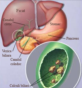 Paraziți în tratamentul vezicii biliare - Paraziți în tratamentul vezicii biliare
