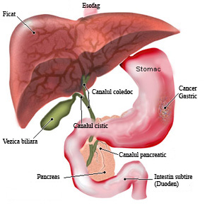 Sanatate la-ndemana cu dr. A. V. Ditoiu: Cancerul gastric, o boala vindecabila