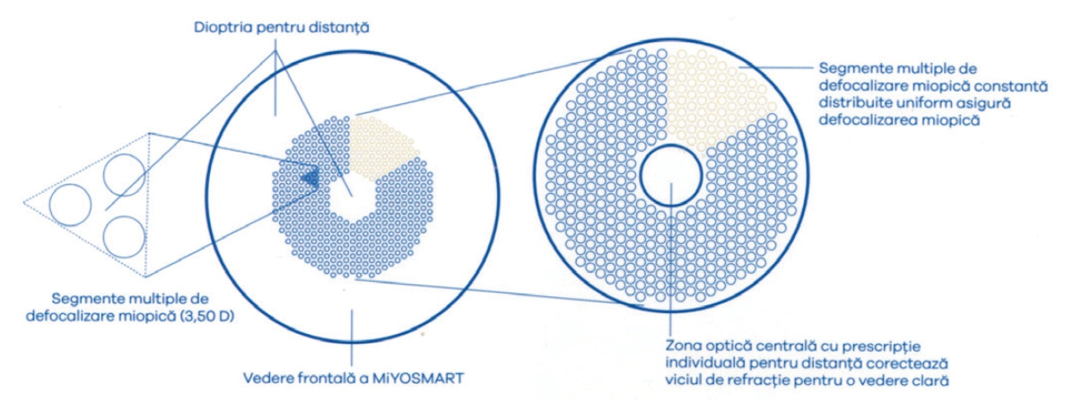 Copil cu lentile MiYOSMART