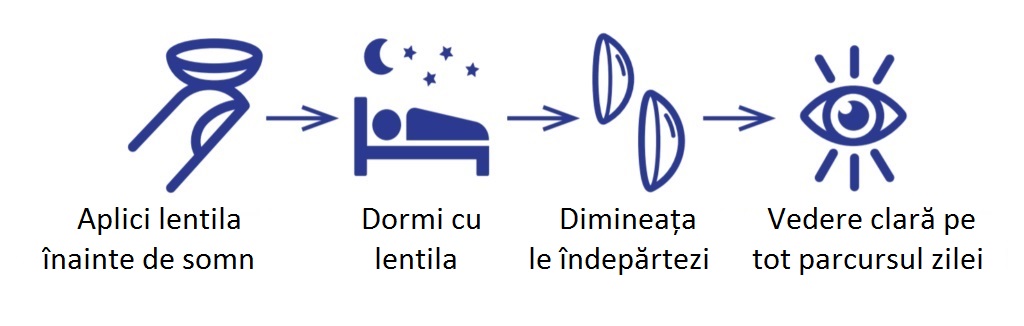 Lentile ortokeratologice pentru terapia refractivă