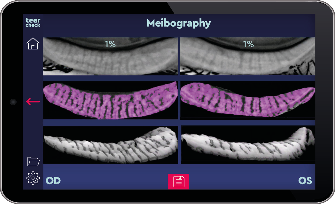 Meibografie IR TearCheck