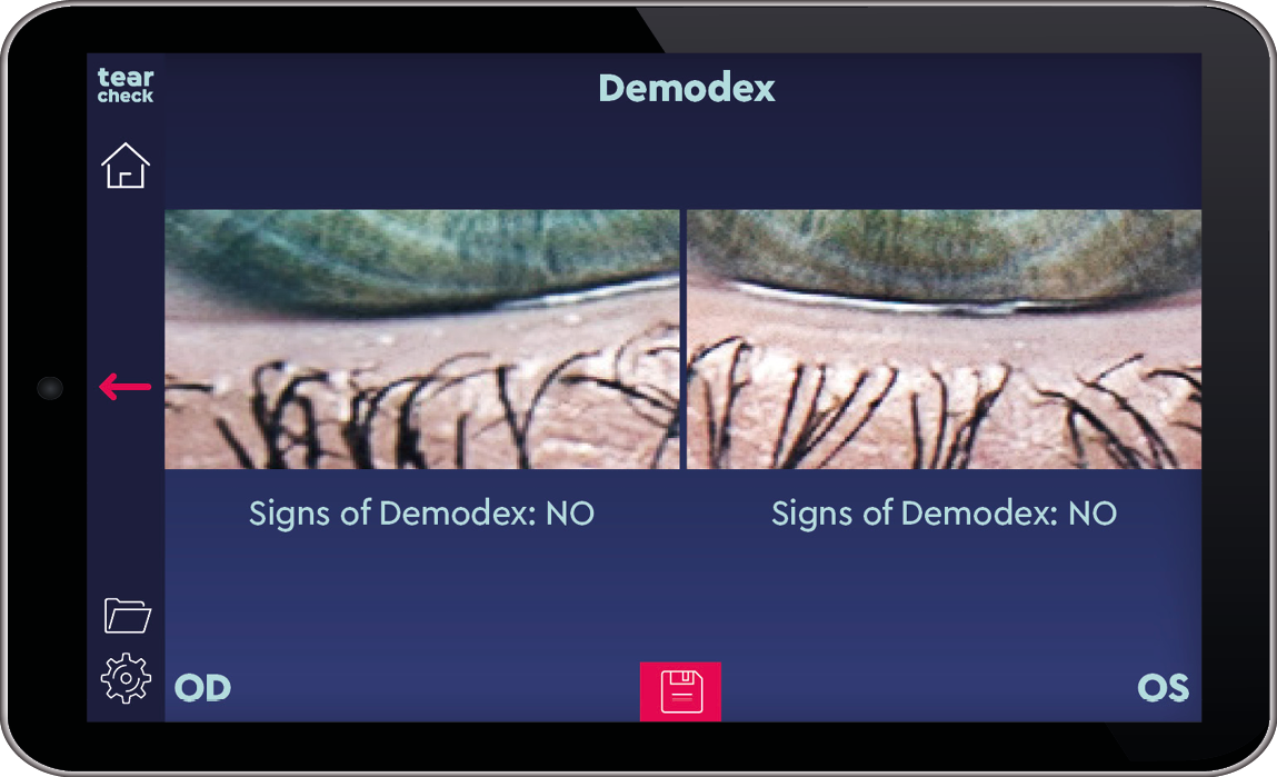 Examinare Demodex TearCheck